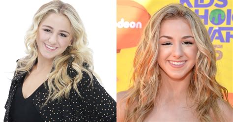 chloe lukasiak eye problem.